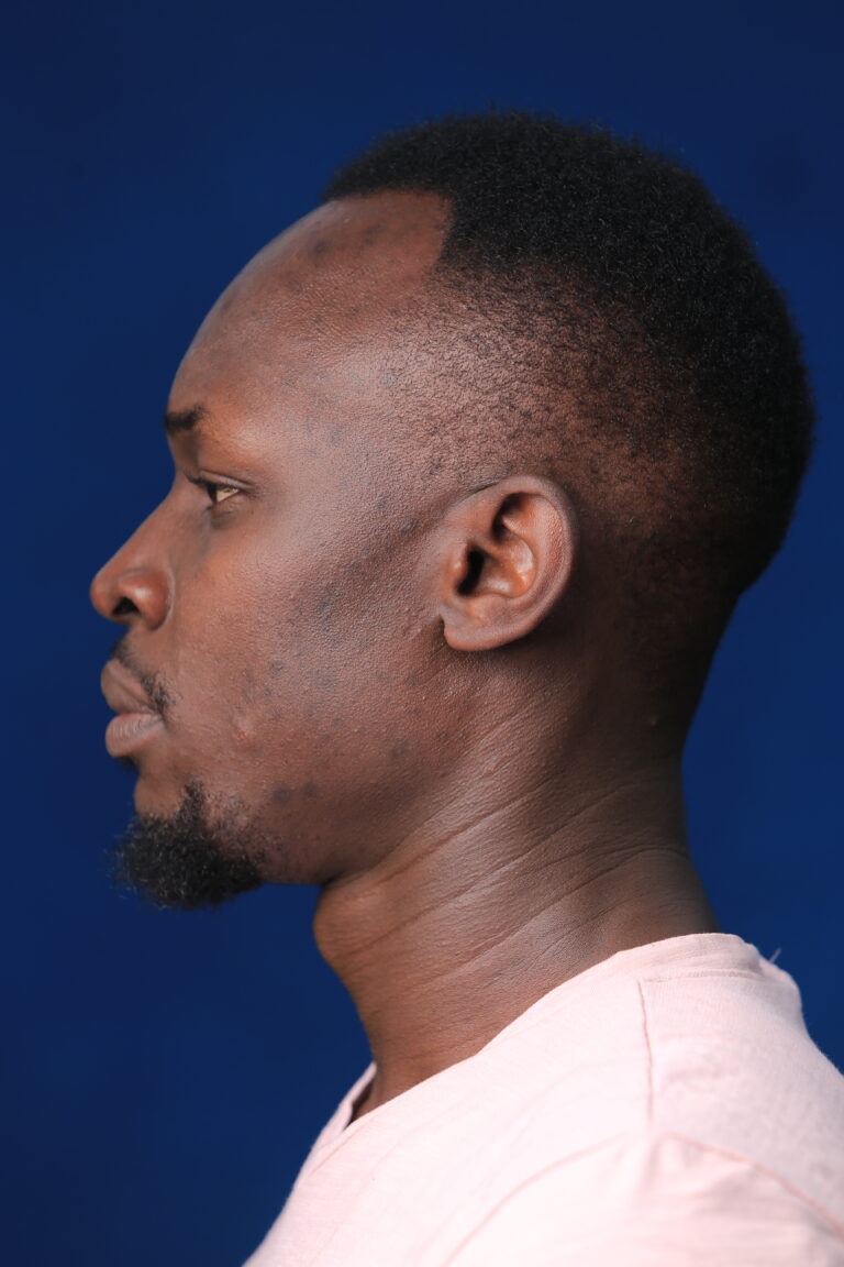 Patrick Ssenyonga